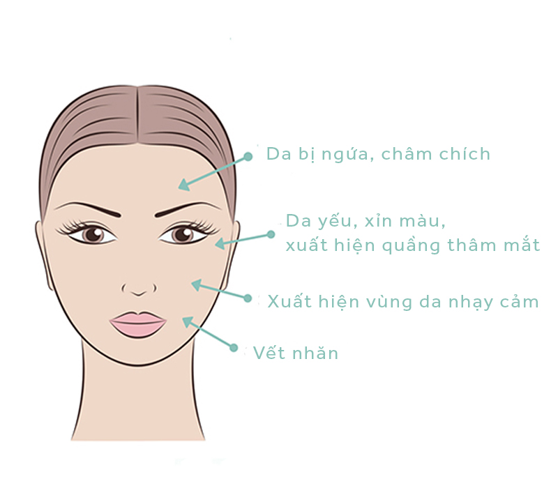 Dấu Hiệu Da Thiếu Độ Ẩm