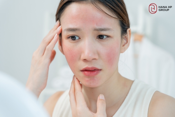 Peel Da Bị Đỏ Rát Và Quy Trình Phục Hồi Cấp Tốc