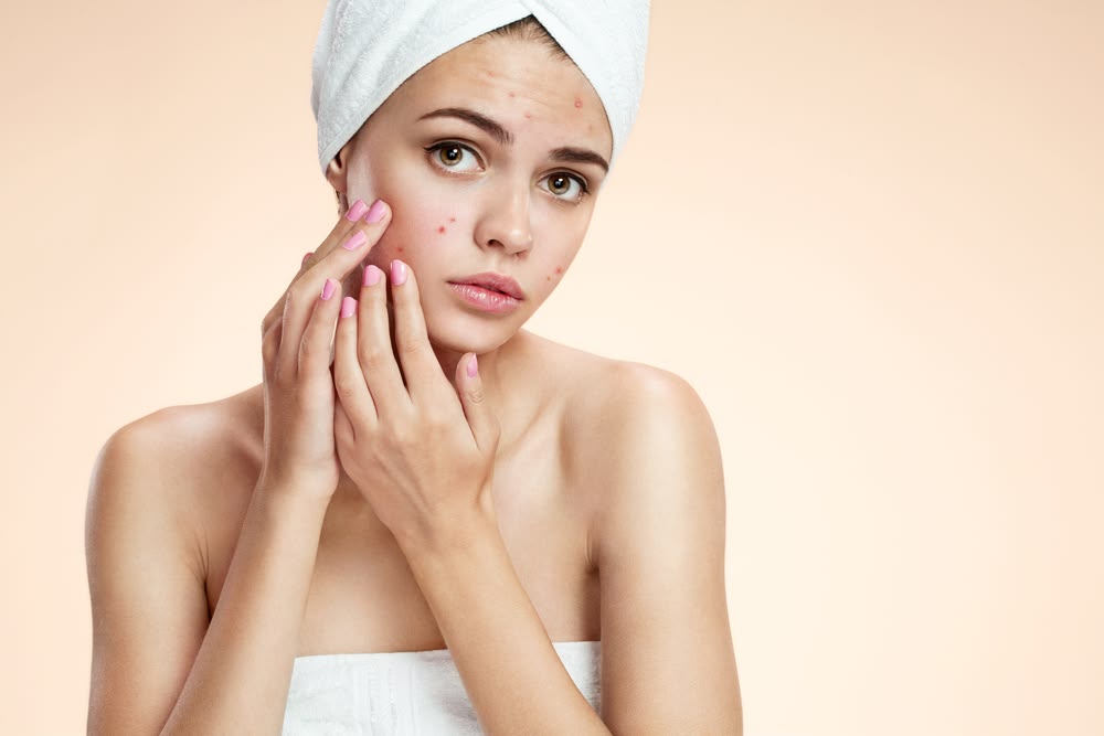 Skin Cycling - Chu Kỳ Dưỡng Da Giúp Phục Hồi Và Trị Mụn