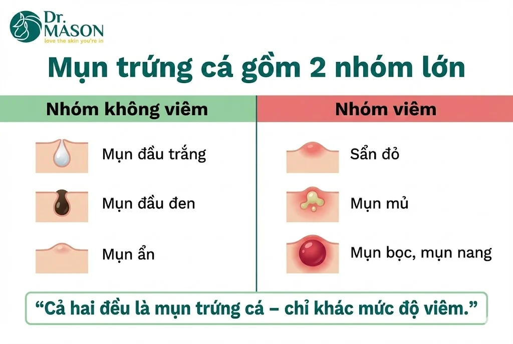 So Sánh Mụn Không Viêm Và Mụn Viêm